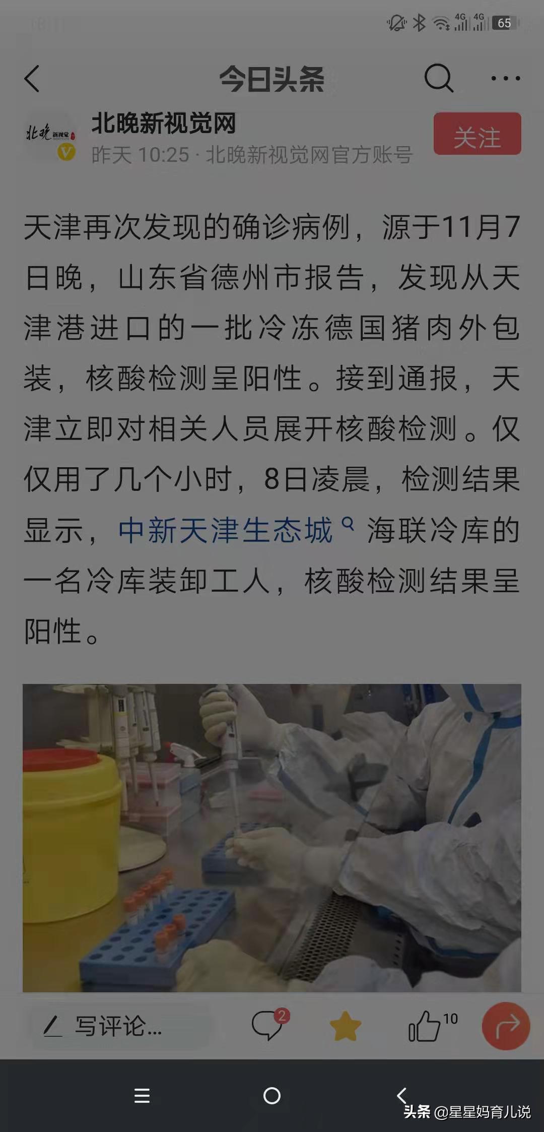 欧洲杯直播官微微博号:欧洲杯直播官微微博号是什么